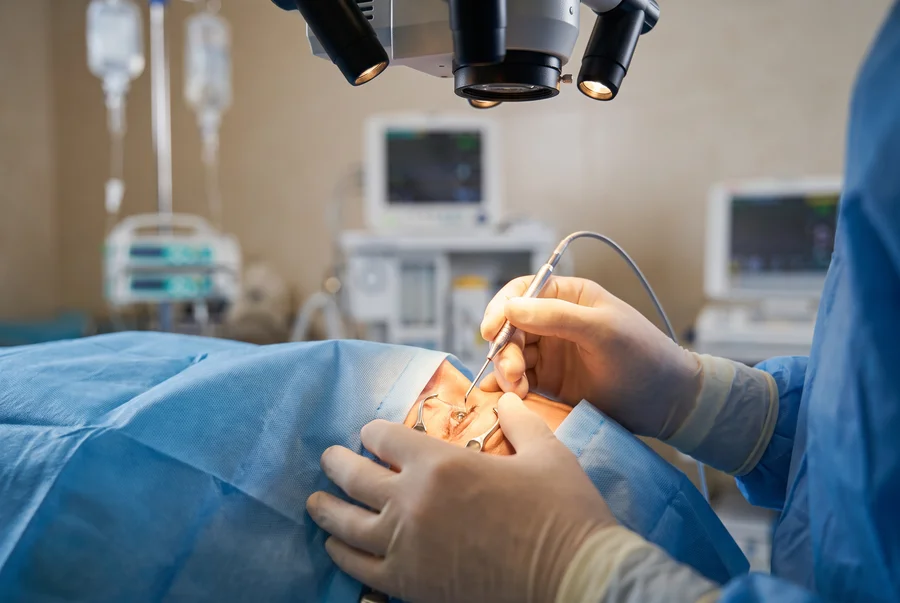 Cirurgia de catarata por facoemulsificação — Dr. Cláudio Vieira