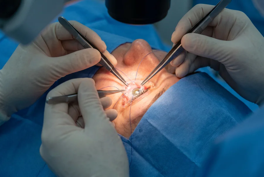 Transplante de córnea — ceratoplastia — Dr. Cláudio Vieira