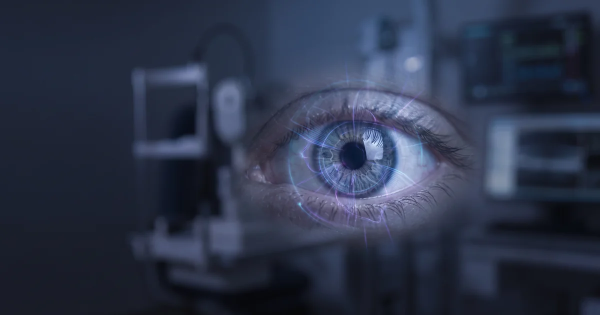 Ilustração do glaucoma com olho humano e visualização abstrata de pressão intraocular